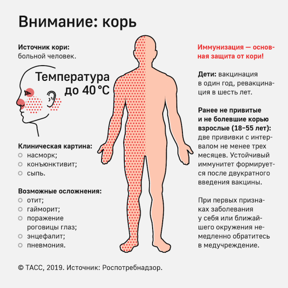 Внимание: корь.